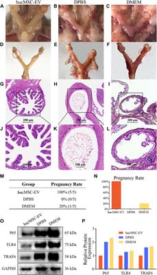 Human umbilical cord mesenchymal stem cells derived extracellular vesicles alleviate salpingitis by promoting M1–to–M2 transformation